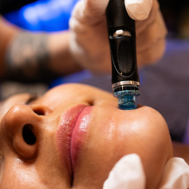 Relaxed woman receiving a Hydrafacial from a Restore esthetician